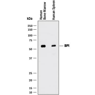 Detection of Human BPI antibody by Western Blot.