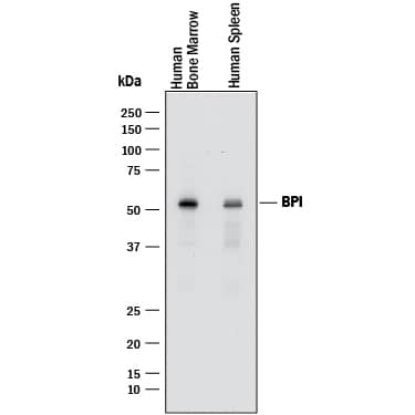 Detection of Human BPI antibody by Western Blot.