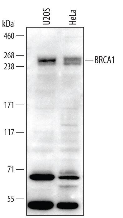 Detection of Human BRCA1 antibody by Western Blot.