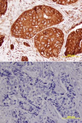 BRCA1 antibody in Human Breast by Immunohistochemistry (IHC-P).