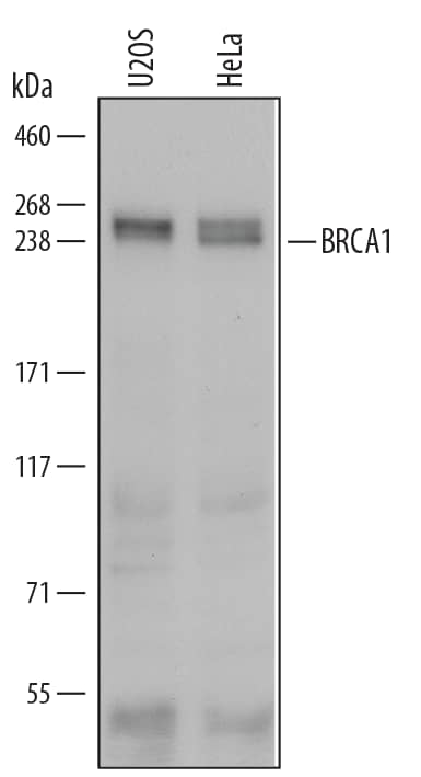 Detection of Human/Mouse BRCA1 antibody by Western Blot.