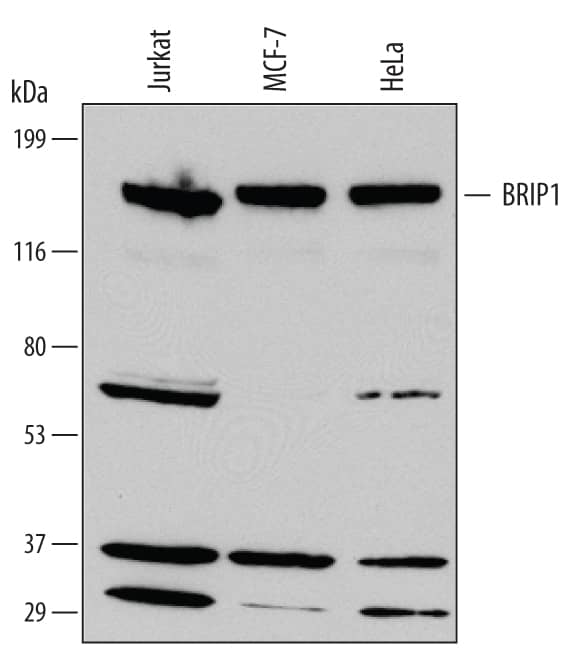 Detection of Human BRIP1/FANCJ antibody by Western Blot.