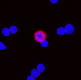 BST-2/Tetherin antibody in Mouse Splenocytes by Immunocytochemistry (ICC).