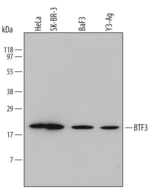 Detection of Human/Mouse/Rat BTF3 antibody by Western Blot.