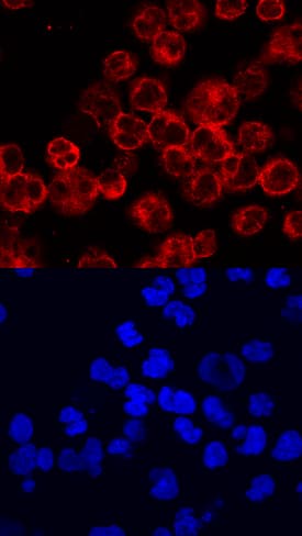 BTK antibody in Raji Human Cell Line by Immunocytochemistry (ICC).