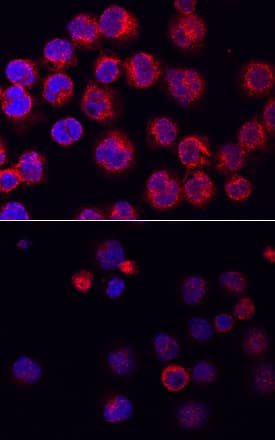 Phospho-BTK (Y223) antibody in Raji Human Cell Line by Immunocytochemistry (ICC).