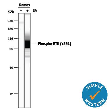 Detection of Human Phospho-BTK (Y551) antibody by Simple WesternTM.