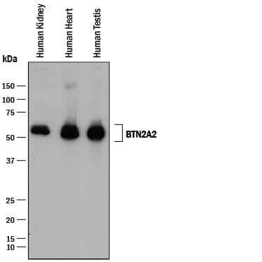 Detection of Human BTN2A2/Butyrophilin 2A2 antibody by Western Blot.