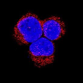 Bad antibody in Jurkat Human Cell Line by Immunocytochemistry (ICC).