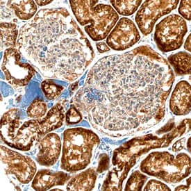 Bad antibody in Human Kidney by Immunohistochemistry (IHC-P).
