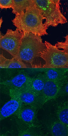 Phospho-Axl (Y779) antibody in A172 Human Cell Line by Immunocytochemistry (ICC).
