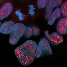 Phospho-Bad (S99) antibody in HEK293 Human Cell Line by Immunocytochemistry (ICC).