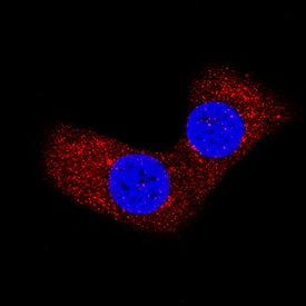Bad antibody in NIH-3T3 Mouse Cell Line by Immunocytochemistry (ICC).