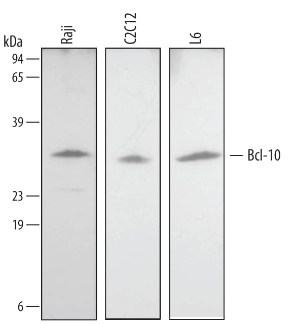 Detection of Human/Mouse/Rat Bcl-10 antibody by Western Blot.