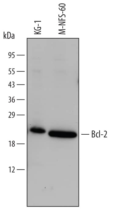 Detection of Human/Mouse Bcl-2 antibody by Western Blot.