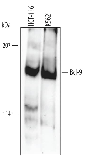 Detection of Human Bcl-9 antibody by Western Blot.