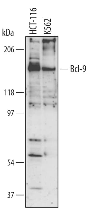 Detection of Human Bcl-9 antibody by Western Blot.