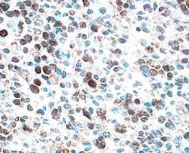 Bcl-w antibody in Human Spleen by Immunohistochemistry (IHC-P).