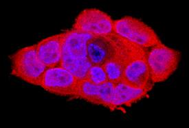 Bcl-10 antibody in A431 Human Cell Line by Immunocytochemistry (ICC).