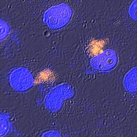 Beclin 1 antibody in HeLa Human Cell Line by Immunocytochemistry (ICC).