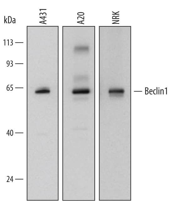 Detection of Human, Mouse, and Rat Beclin 1 antibody by Western Blot.