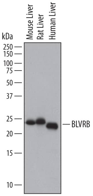 Detection of Human, Mouse, and Rat Biliverdin Reductase B/BLVRB antibody by Western Blot.