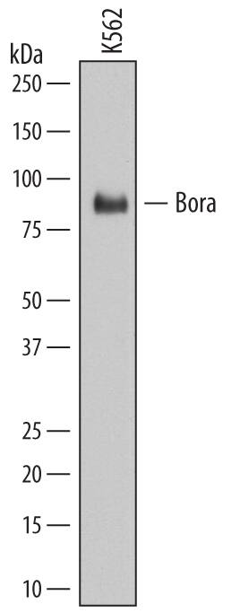 Detection of Human Bora antibody by Western Blot.