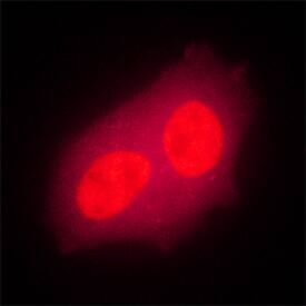 Bora antibody in MCF-7 Human Cell Line by Immunocytochemistry (ICC).