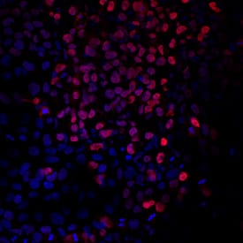 Brachyury antibody in BG01V Human Stem Cells by Immunocytochemistry (ICC).