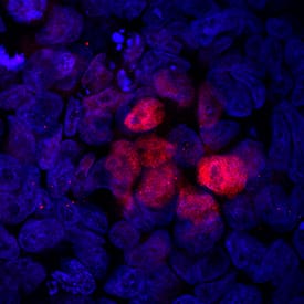 Brachyury antibody in BG01V Human Embryonic Stem Cells by Immunocytochemistry (ICC).