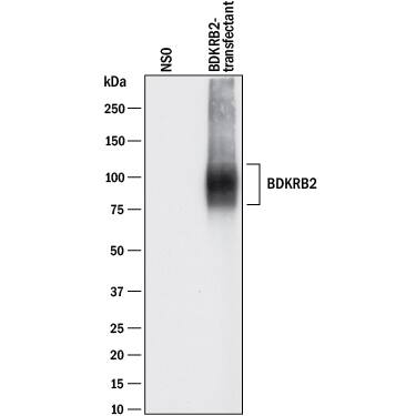 Detection of Human Bradykinin RB2/BDKRB2 antibody by Western Blot.