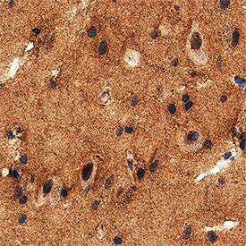 Brevican antibody in Human Brain by Immunohistochemistry (IHC-P).