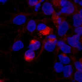 Brevican antibody in Rat Cortical Stem Cells by Immunocytochemistry (ICC).