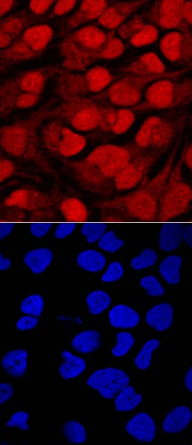 Brg1 antibody in HeLa Human Cell Line by Immunocytochemistry (ICC).