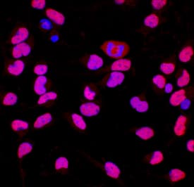 Brg1 antibody in Rat Cortical Stem Cells by Immunocytochemistry (ICC).