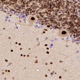 Brg1 in Human Brain. Brg1 antibody in Human Brain by Immunohistochemistry (IHC-P).