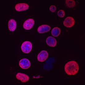 Bromodeoxyuridine/BrdU antibody in MCF-7 Human Cell Line by Immunocytochemistry (ICC).