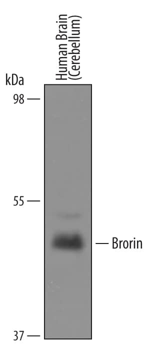 Detection of Human Brorin/VWC2 antibody by Western Blot.