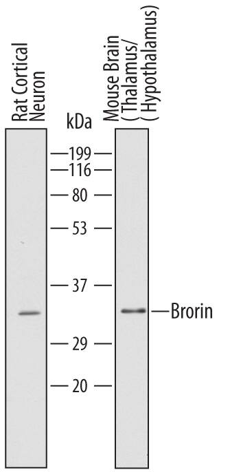 Detection of Mouse and Rat Brorin/VWC2 antibody by Western Blot.