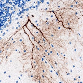 Brorin/VWC2 antibody in Human Brain by Immunohistochemistry (IHC-P).