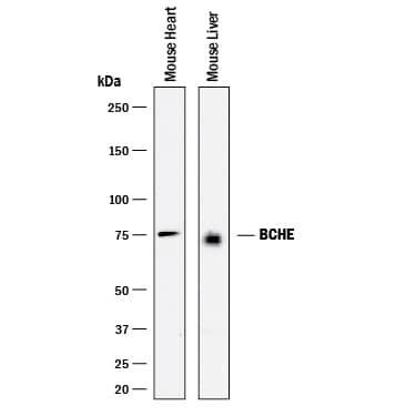 Detection of Mouse Butyrylcholinesterase/BCHE antibody by Western Blot.