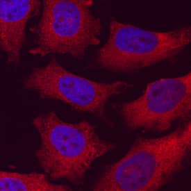 C2CD3 antibody in HeLa Human Cell Line by Immunocytochemistry (ICC).