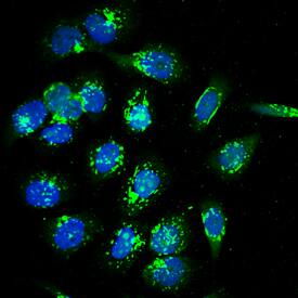 Calcium Activated Nucleotidase 1/CANT1 antibody in PC-3 Human Cell Line by Immunocytochemistry (ICC).