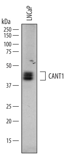 Detection of Human Calcium Activated Nucleotidase 1/CANT1 antibody by Western Blot.