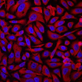 Calcium Activated Nucleotidase 1/CANT1 antibody in PC-3 Human Cell Line by Immunocytochemistry (ICC).