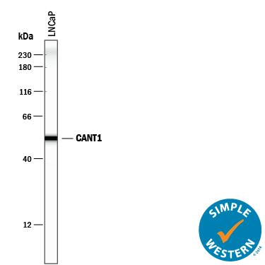 Detection of Human Calcium Activated Nucleotidase 1/CANT1 antibody by Simple WesternTM.