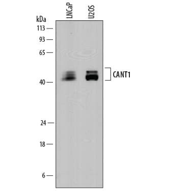 Detection of Human Calcium Activated Nucleotidase 1/CANT1 antibody by Western Blot.