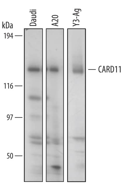 Detection of Human/Mouse/Rat CARD11/CARMA1 antibody by Western Blot.