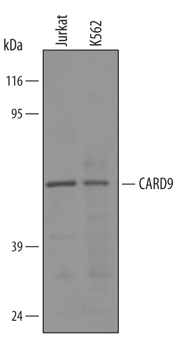 Detection of Human CARD9 antibody by Western Blot.