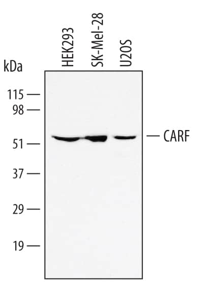 Detection of Human CARF antibody by Western Blot.